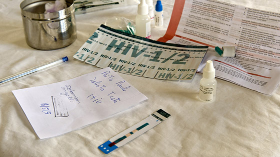 HIV-Test-Set