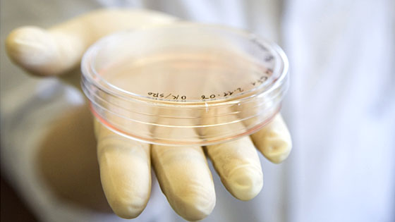 Hand hlt eine Petrischale mit embryonalen Stammzellen